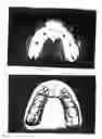 Fig. 09 - Dental crowns