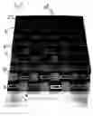 Fig. 04 - Gaming apparatus using integrated rollers for game pieces