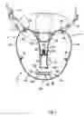 Fig. 03 - Occupant restraint apparatus