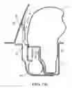 Fig. 03 - Air bag system