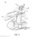 Fig. 02 - Tethered fastener apparatus and method