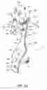 Fig. 10 - Saddle seat assembly