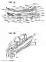 Fig. 05 - Headrest assembly with improved flexibility for a massage device