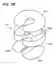 Fig. 14 - Headrest assembly with improved flexibility for a massage device