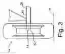 Fig. 04 - Wheel-end mounted multipurpose acceleration sensing device