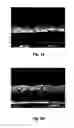 Fig. 04 - Lamp with phosphor layer on an exterior surface and method of applying the phosphor layer