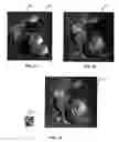 Fig. 02 - Method and apparatus for implementing level of detail with ray tracing