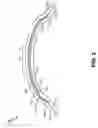 Fig. 03 - LAMINATED CONTACT LENS