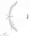 Fig. 05 - LAMINATED CONTACT LENS