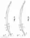 Fig. 10 - LAMINATED CONTACT LENS