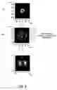 Fig. 07 - Illumination optical system and projection display optical system