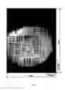 Fig. 06 - Optical scanning zoom microscope with high magnification and a large field of view