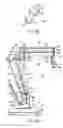 Fig. 10 - Surgical microscope