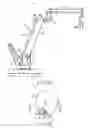 Fig. 18 - Surgical microscope