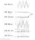 Fig. 06 - Digital-signal-processing apparatus and method
