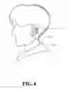 Fig. 07 - Adjustable headset structure