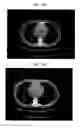 Fig. 06 - Digital medical image analysis