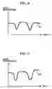 Fig. 06 - Signal processing apparatus, signal processing method, program, and recording medium for enhancing voice
