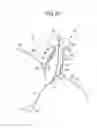 Fig. 28 - Fixing device