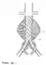 Fig. 03 - Devices and methods for treatment of vascular aneurysms