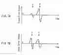 Fig. 08 - Optical information recording medium, method for manufacturing the same, and initialization device