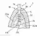 Fig. 01 - Dental prosthesis implant construction