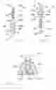 Fig. 03 - Dental prosthesis implant construction