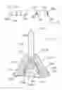 Fig. 08 - Dental prosthesis implant construction