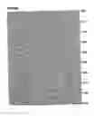 Fig. 93 - Method of detecting antibodies to HCV