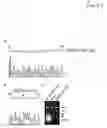 Fig. 04 - Heart failure assessment based on alpha-2C adrenergic receptor polymorphisms