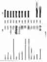 Fig. 02 - NOD nucleic acids and polypeptides