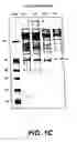 Fig. 04 - Cloning, sequencing and expression of a gene encoding an eukaryotic amino acid racemase, and diagnostic, therapeutic, and vaccination applications of parasite and viral mitogens