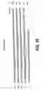 Fig. 31 - Cloning, sequencing and expression of a gene encoding an eukaryotic amino acid racemase, and diagnostic, therapeutic, and vaccination applications of parasite and viral mitogens