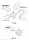 Fig. 03 - Comparative genomic hybridization