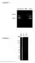 Fig. 04 - METHODS AND COMPOUNDS FOR PREVENTION AND TREATMENT OF ELEVATED INTRAOCULAR PRESSURE AND RELATED CONDITIONS