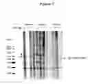 Fig. 06 - Diagnostic methods for the detection of autism spectrum disorder
