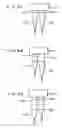 Fig. 07 - Analyte recovering device, and analyte recovering method