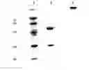 Fig. 01 - Monoclonal antibody with the capability of neutralizing enterovirus type 71 infection