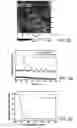 Fig. 04 - Architecture for high efficiency polymer photovoltaic cells using an optical spacer
