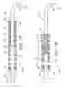 Fig. 10 - Method of deployable medical lead fixation