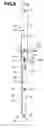 Fig. 03 - Surgical instrument