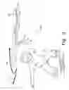 Fig. 04 - Projectile toy