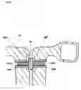 Fig. 04 - Exercise device for facial muscles