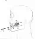 Fig. 05 - Exercise device for facial muscles