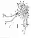 Fig. 06 - EXERCISE EQUIPMENT WITH CONVERGENT HAND GRIPS