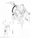 Fig. 06 - Therapeutic exercise device