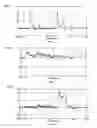 Fig. 02 - Harmful substance decomposer and method of producing the same