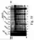 Fig. 11 - Inactivation resistant factor VIII