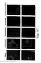 Fig. 04 - Inhibition of gene expression using RNA interfering agents