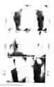 Fig. 07 - Promotion of wound healing
